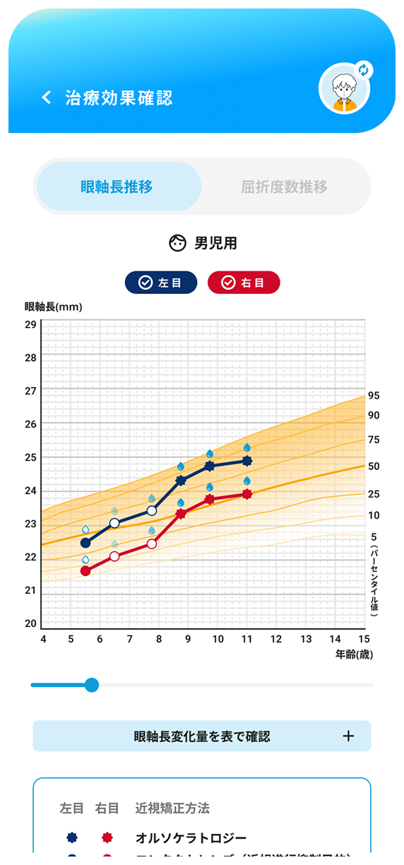 ミオログのスクリーンショット